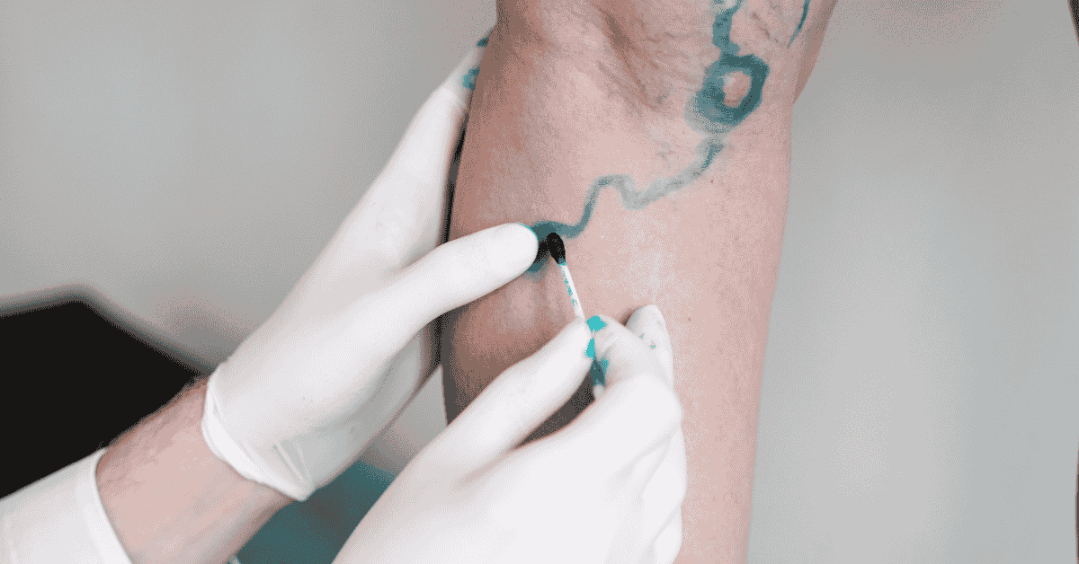 Why Your Legs Feel Heavy at the End of the Day — and What a Vascular Exam Can Reveal