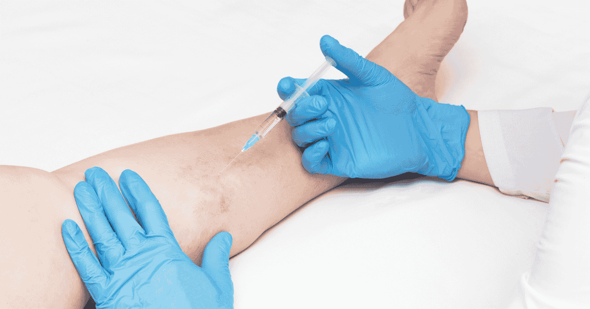 Why Minimally Invasive Vein Treatments Are Replacing Traditional Surgery