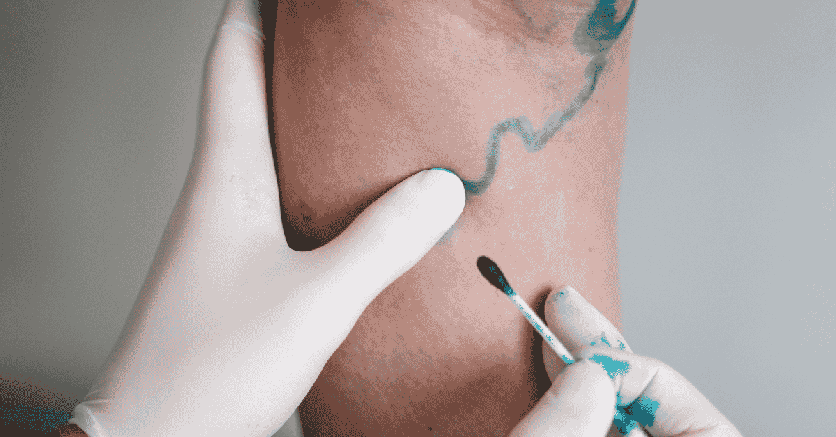 What to Expect During Your First Vein Evaluation at Laser Vascular Center