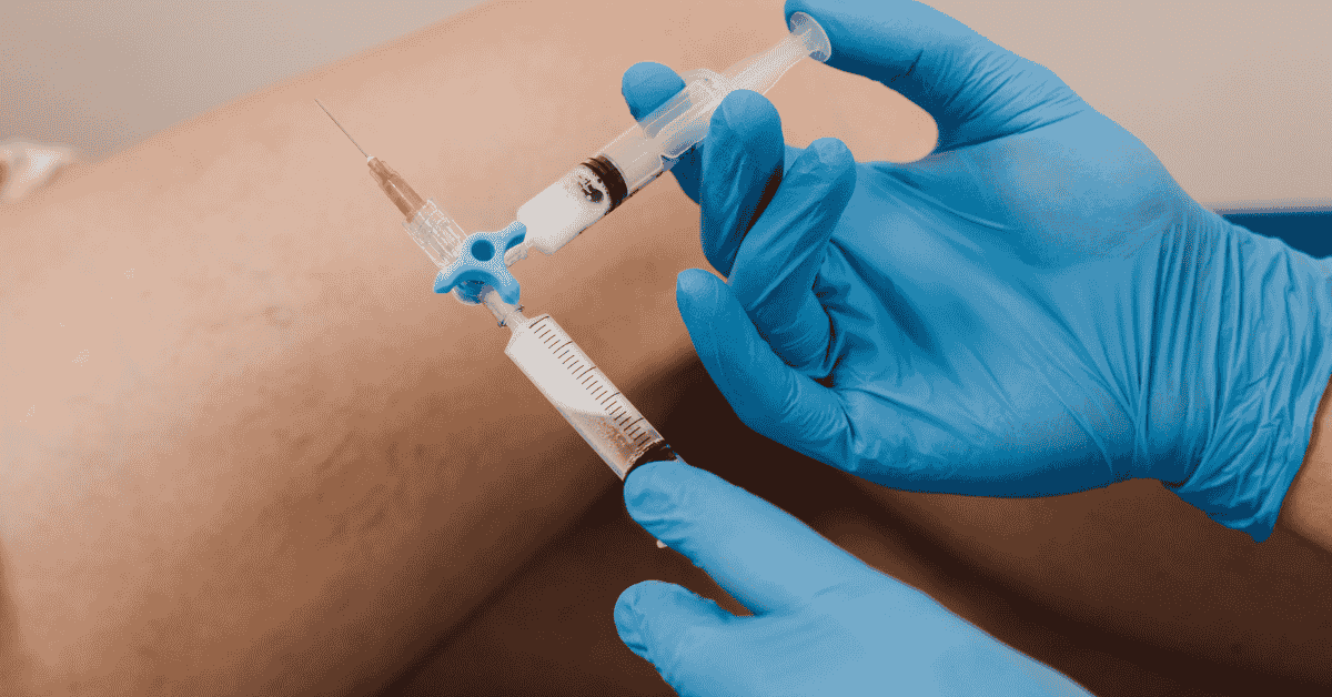 Why Minimally Invasive Vein Treatments Are Replacing Traditional Vein Surgery