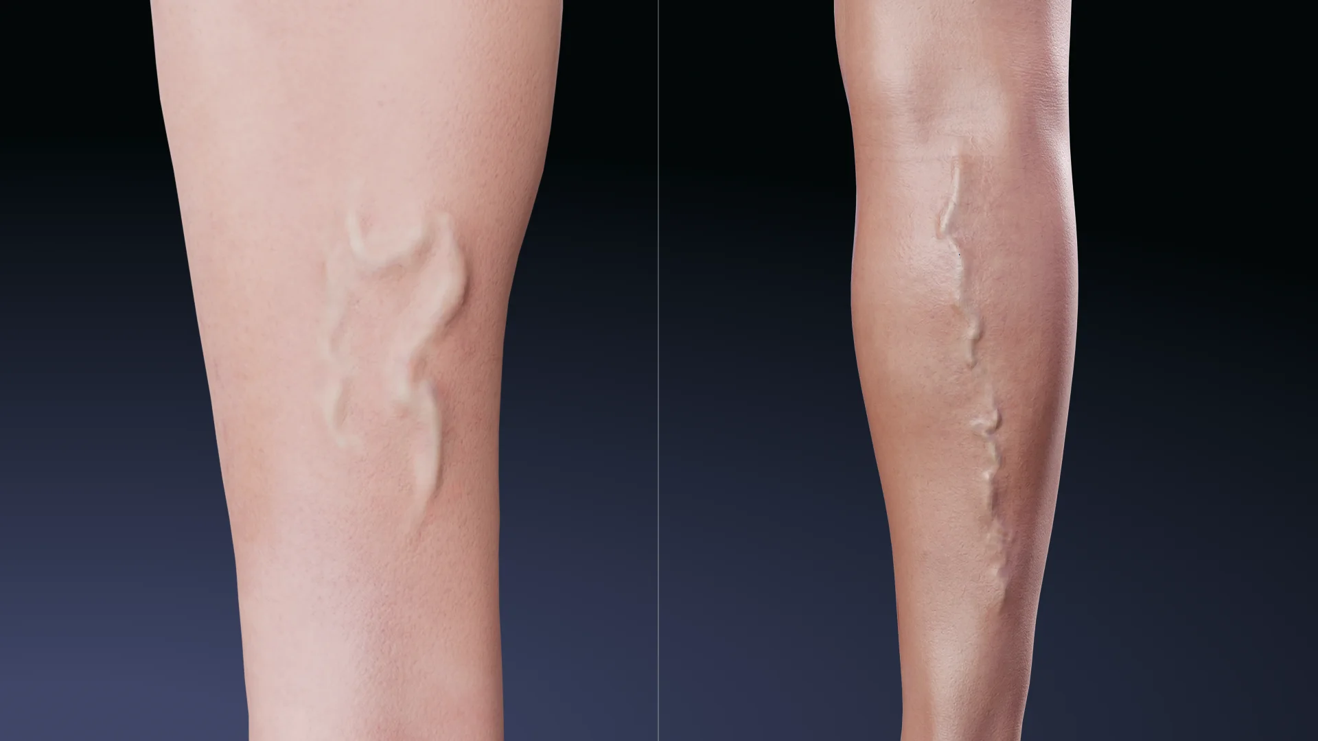 Why Varicose Veins Treatment in Phoenix Matters for Healthy Legs and Better Circulation Why Varicose Veins Treatment in Phoenix Matters for Healthy Legs and Better Circulation