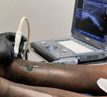 Lower-Limb Venous Duplex Ultrasound Examination